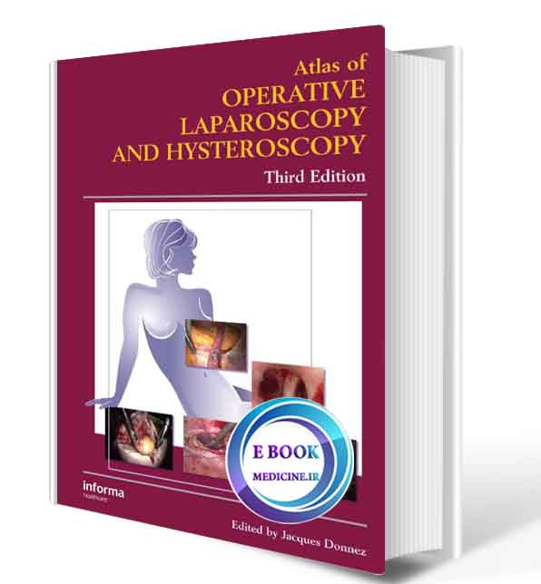 دانلود کتابAtlas of Operative Laparoscopy and Hysteroscopy (Encyclopedia of Visual Medicine Series) (ORIGINAL PDF) 